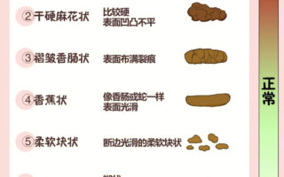 从便便看健康