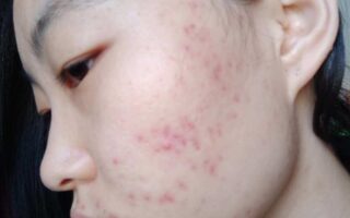 女性绝经前后，身体会有哪些变化？